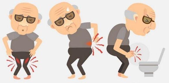 Síntomas de prostatitis