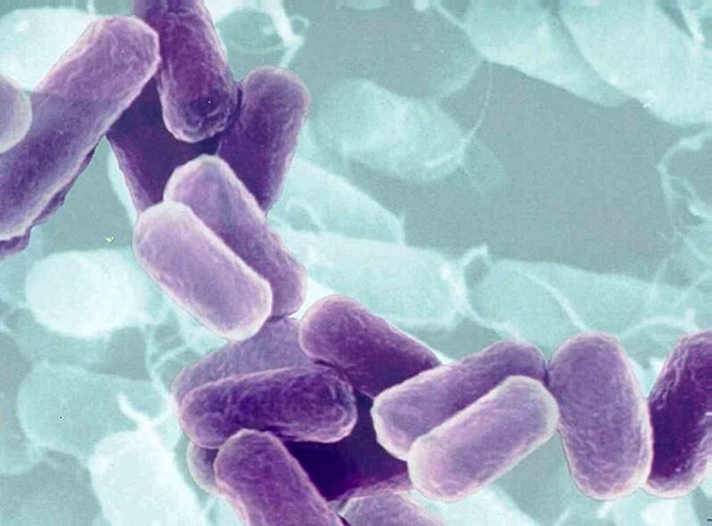 Prostatitis Agentes causales en hombres con enfermedades de transmisión sexual