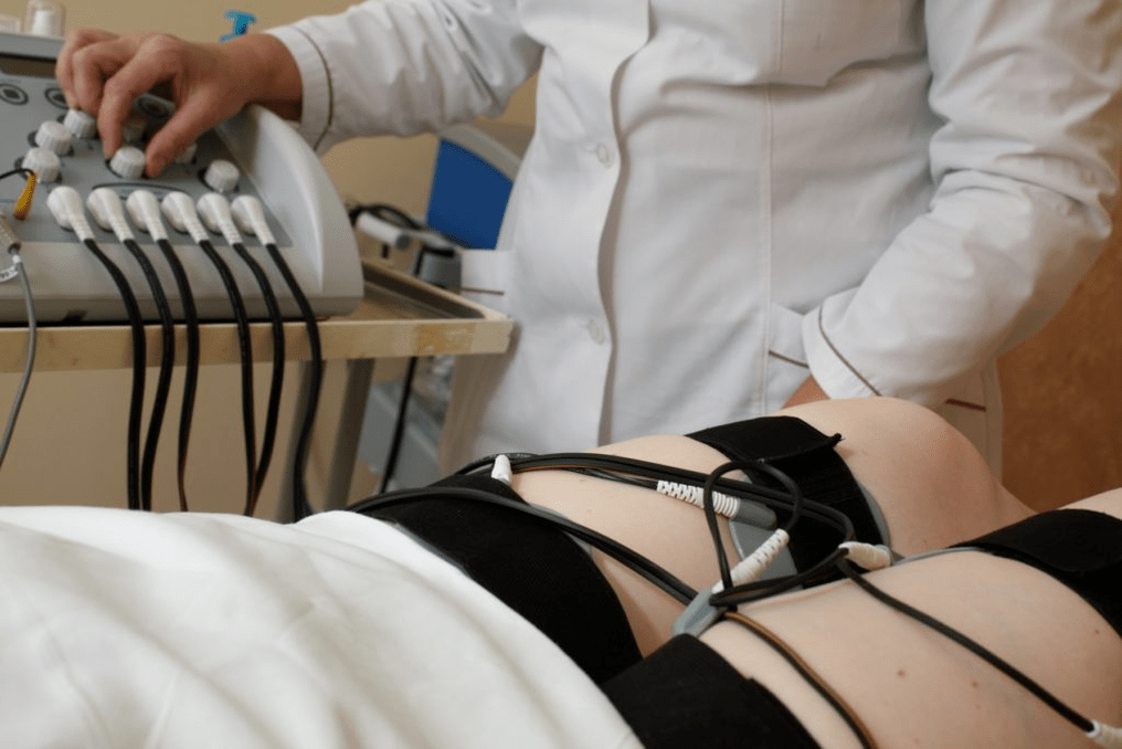 Dispositivos para estimulación eléctrica de la próstata.