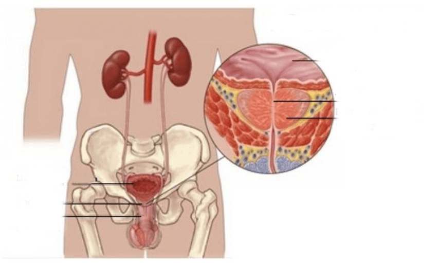 prostatitis en hombres