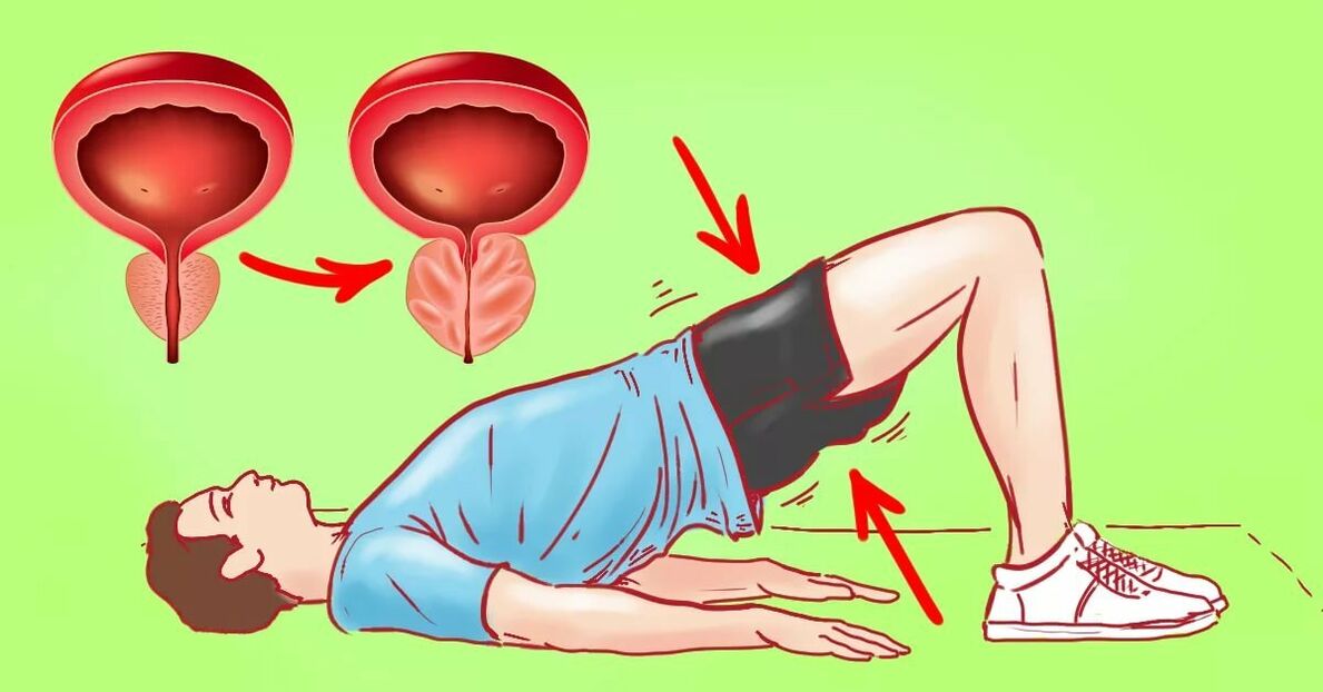 Ejercicios para la prostatitis.